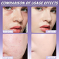 Matte Concealer for Face & Body